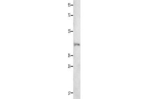 Western Blotting (WB) image for anti-Neurotensin Receptor 1 (High Affinity) (NTSR1) antibody (ABIN2426287) (NTSR1 抗体)