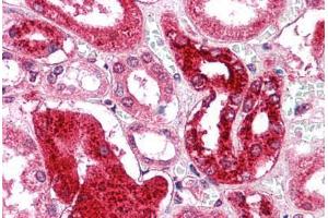 Human Kidney: Formalin-Fixed, Paraffin-Embedded (FFPE) (GM2A 抗体  (N-Term))
