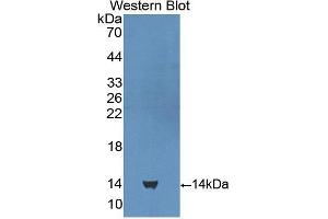 Western blot analysis of the recombinant protein. (CUBN 抗体  (AA 3511-3623))