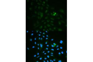 Immunofluorescence analysis of MCF7 cell using CD79B antibody. (CD79b 抗体)