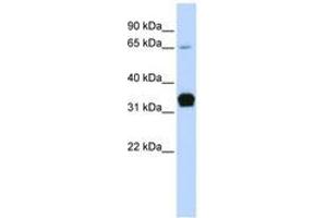 Image no. 1 for anti-Slow Skeletal Troponin T (TNNT1) (C-Term) antibody (ABIN6740747)