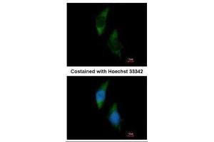 ICC/IF Image Immunofluorescence analysis of methanol-fixed HeLa, using FARSLA, antibody at 1:200 dilution. (Phenylalanyl-tRNA Synthetase, alpha Subunit (FARSA) 抗体)