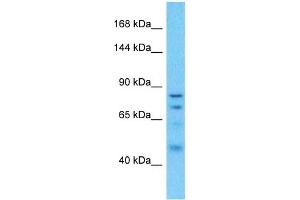 Host:  Rabbit  Target Name:  CGN  Sample Type:  Uterus Tumor lysates  Antibody Dilution:  1. (Cingulin 抗体  (N-Term))
