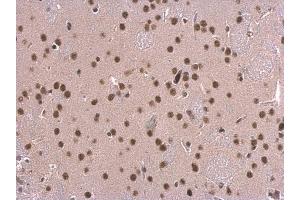 Immunohistochemistry (IHC) image for anti-Small Nuclear Ribonucleoprotein D2 Polypeptide 16.5kDa (SNRPD2) antibody (ABIN2855196)