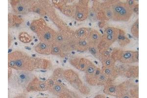 DAB staining on IHC-P; Samples: Human Liver Tissue (HDC 抗体  (AA 160-369))