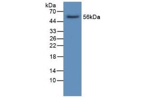 Detection of LIPC in Human Liver Tissue using Polyclonal Antibody to Lipase, Hepatic (LIPC) (LIPC 抗体  (AA 25-247))