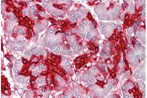 Rabbit Anti-ANXA4 antibody  Formalin Fixed Paraffin Embedded Tissue: Human Adult Pancreas  Observed Staining: Cytoplasm in hepatocytes Primary Antibody Concentration: 1:600 Secondary Antibody: Donkey anti-Rabbit-Cy3 Secondary Antibody Concentration: 1:200 Magnification: 20X Exposure Time: 0. (Annexin IV 抗体  (Middle Region))