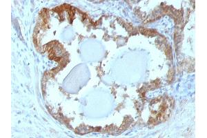 Immunohistochemistry (IHC) image for anti-Heat Shock 27kDa Protein 1 (HSPB1) antibody (ABIN6939661)