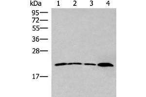 Western blot analysis of 231 cell Human breast cancer tissue Raji cell Human fetal liver tissue lysates using IFNA5 Polyclonal Antibody at dilution of 1:400 (IFNA5 抗体)