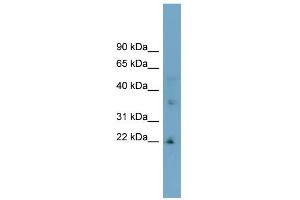 WB Suggested Anti-LDLRAD1 Antibody Titration:  0. (LDLRAD1 抗体  (Middle Region))