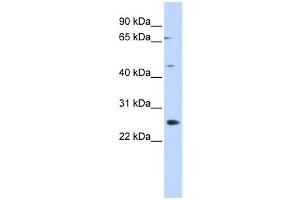 Western Blotting (WB) image for anti-Spermatogenesis Associated 22 (SPATA22) antibody (ABIN2460089) (SPATA22 抗体)