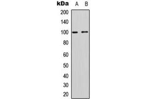 Western blot analysis of CD167a expression in Jurkat (A), rat muscle (B) whole cell lysates. (DDR1 抗体  (C-Term))
