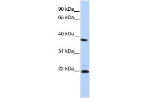 WB Suggested Anti-PSMB2 Antibody Titration: 0. (PSMB2 抗体  (Middle Region))