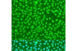 Immunofluorescence analysis of U2OS cells using HNRNPDL Polyclonal Antibody at dilution of 1:100. (HNRPDL 抗体)