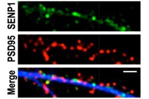 Immunolabelling of fixed primary rat hippocampal neurons for SENP1 and PSD95.