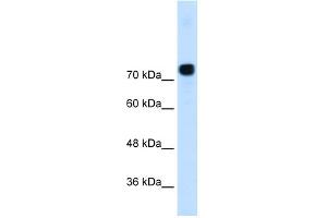 WB Suggested Anti-ACTN4 Antibody Titration:  0. (alpha Actinin 4 抗体  (N-Term))