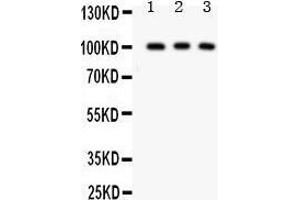 Anti- CD146 antibody, Western blotting All lanes: Anti CD146  at 0. (MCAM 抗体  (AA 59-401))