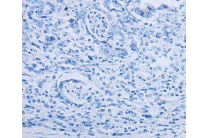 Immunohistochemistry (IHC) image for anti-Par-6 Partitioning Defective 6 Homolog alpha (PARD6A) antibody (ABIN1874031) (PARD6A 抗体)