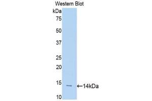 Western blot analysis of the recombinant protein. (SLIT1 抗体  (AA 3-112))