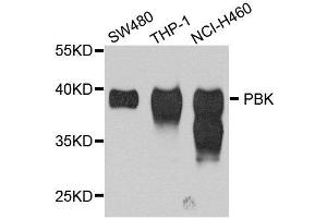 Western blot analysis of extract of various cells, using SPK antibody. (Symplekin 抗体)