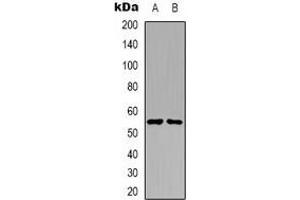 Western blot analysis of PKE expression in A431 (A), Raji (B) whole cell lysates. (STK32C 抗体)