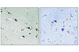 Immunohistochemical analysis of paraffin-embedded humanbrain tissue, using MAP2K7 (Phospho-Ser271) antibody (left)or the same antibody preincubated with blocking peptide (right). (MAP2K7 抗体  (pSer271))
