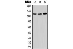 Western blot analysis of ADAMTS10 expression in HeLa (A), PC12 (B), Raw264. (ADAMTS10 抗体  (Center))