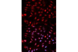 Immunofluorescence analysis of HeLa cells using APEX1 antibody. (APEX1 抗体  (AA 1-318))