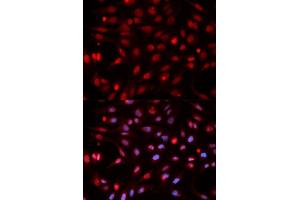 Immunofluorescence analysis of HeLa cells using APEX1 antibody. (APEX1 抗体  (AA 1-318))