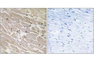 Immunohistochemistry analysis of paraffin-embedded human heart tissue, using MRPL46 Antibody. (MRPL46 抗体  (AA 111-160))