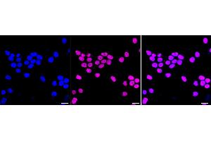 Immunocytochemical staining of HeLa cells with Phospho-Nrf2 (S40) antibody (ABIN7799630), 1:1,000). (Recombinant NRF2 抗体  (pSer40))