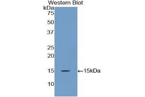 Detection of Recombinant RNASEN, Human using Polyclonal Antibody to Ribonuclease III, Nuclear (RNASEN) (DROSHA 抗体  (AA 1114-1235))