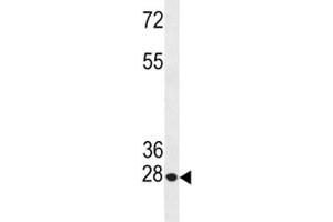 Western Blotting (WB) image for anti-B-Cell CLL/lymphoma 2 (BCL2) (AA 49-76) antibody (ABIN3030096)