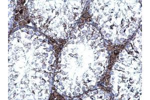 IHC-P Image TrxR1 antibody [N1N3] detects TrxR1 protein at cytoplasm on mouse testis by immunohistochemical analysis. (TXNRD1 抗体)