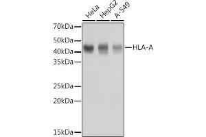 Western blot analysis of extracts of various cell lines, using HLA-A antibody (ABIN7268366) at 1:1000 dilution. (HLA-A 抗体)