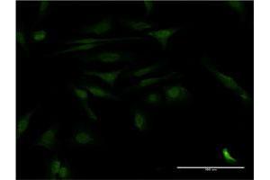 Immunofluorescence of monoclonal antibody to CALCOCO2 on HeLa cell. (CALCOCO2 抗体  (AA 347-446))