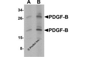 Western Blotting (WB) image for anti-Platelet Derived Growth Factor Subunit B (PDGFB) (C-Term) antibody (ABIN1077433) (PDGFB 抗体  (C-Term))