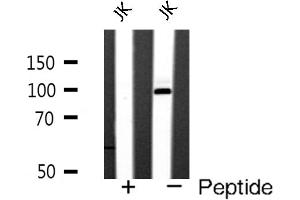 Western blot analysis of GluR4 expression in JK cells (Metabotropic Glutamate Receptor 4 抗体  (C-Term))