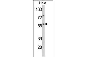 Western blot analysis of SARS2 Antibody in Hela cell line lysates (35ug/lane) (SARS2 抗体  (AA 315-344))