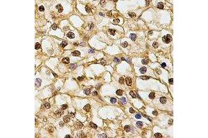 Immunohistochemical analysis of DNAJB6 staining in human kidney formalin fixed paraffin embedded tissue section.
