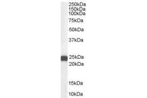 Image no. 1 for anti-BCL2-Associated Athanogene 2 (BAG2) (C-Term) antibody (ABIN374110) (BAG2 抗体  (C-Term))