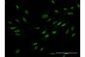 Immunofluorescence of purified MaxPab antibody to ZCCHC9 on HeLa cell. (ZCCHC9 抗体  (AA 1-271))