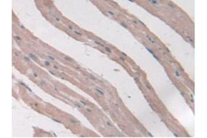 Figure. (Adiponectin Receptor 2 抗体  (AA 1-147))