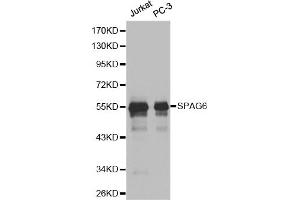 Western blot analysis of extracts of various cell lines, using SPAG6 antibody (ABIN6291215). (SPAG6 抗体)
