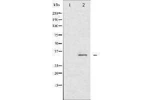Western Blotting (WB) image for anti-Cyclin-Dependent Kinase 1 (CDK1) (pTyr15) antibody (ABIN6255816)