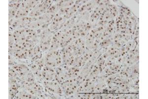 Image no. 1 for anti-A Kinase (PRKA) Anchor Protein 8 (AKAP8) (AA 551-663) antibody (ABIN599126) (AKAP8 抗体  (AA 551-663))