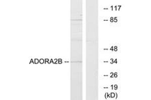Western Blotting (WB) image for anti-Adenosine A2b Receptor (ADORA2B) (AA 231-280) antibody (ABIN2890803)