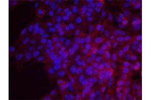 Immunofluorescence (IF) image for anti-Epidermal Growth Factor Receptor (EGFR) antibody (ABIN2664938) (EGFR 抗体)