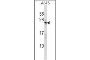 Western blot analysis in A375 cell line lysates (35ug/lane). (SARNP 抗体  (AA 81-110))