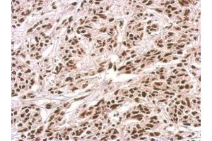 IHC-P Image PUF60 antibody detects PUF60 protein at nucleus on U251 xenograft by immunohistochemical analysis. (PUF60 抗体)